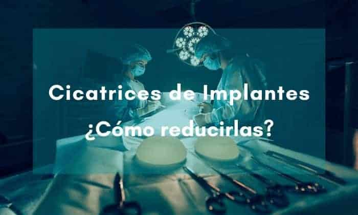 imagen sala de cirugía de aumento de pecho con texto sobre parches cicatrizantes Parches cicatrizantes para eliminar cicatrices de mama por aumento de pecho o mastopexia: Trofolastin, elix·care y Mepiform